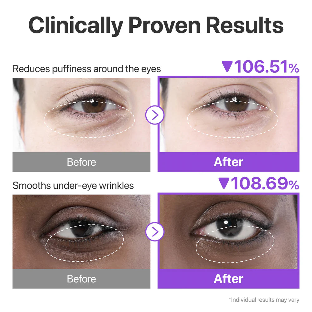 No.9 NAD+ Collagen Under Eye Patches