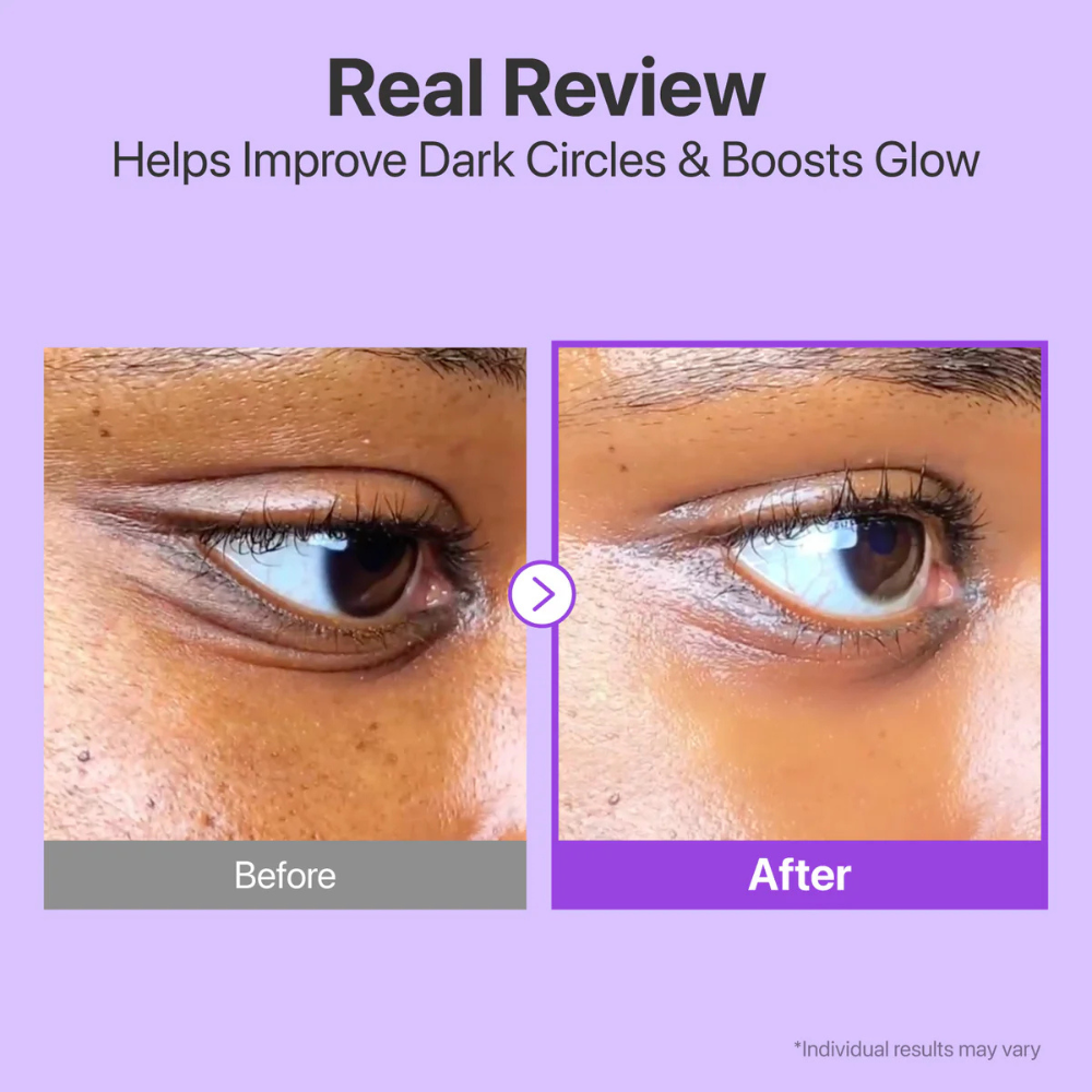 NO.9 NAD+ RETINOL VOLUMETOX EYE CREAM
