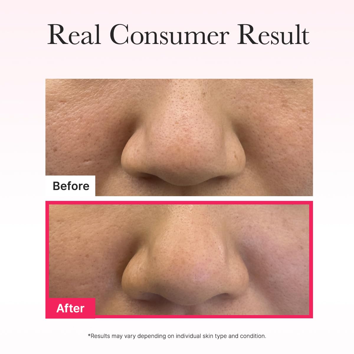 RED COLLAGEN JELLO MASK 4-Pack