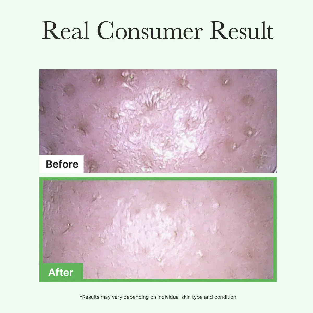 Pore Melt Mochi Makeup-Removing Cleansing Oil