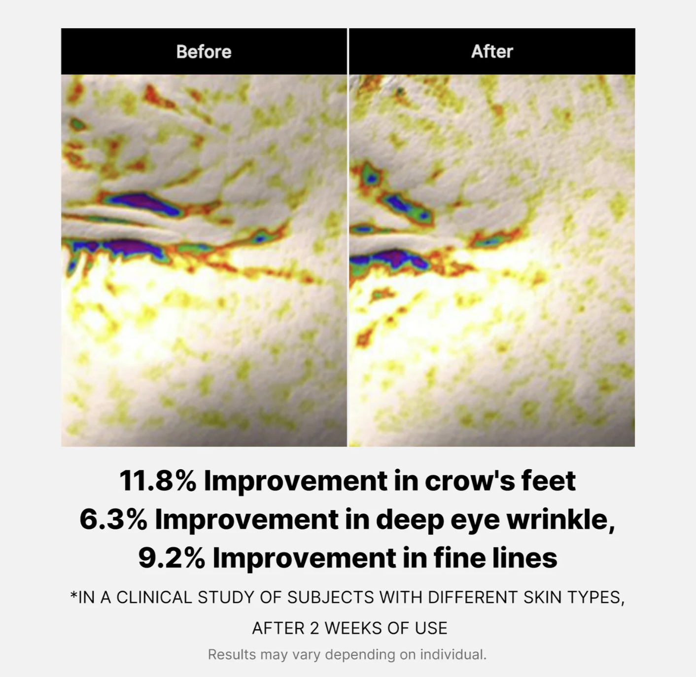 Deep Lifting Peptide Eye Cream For Face