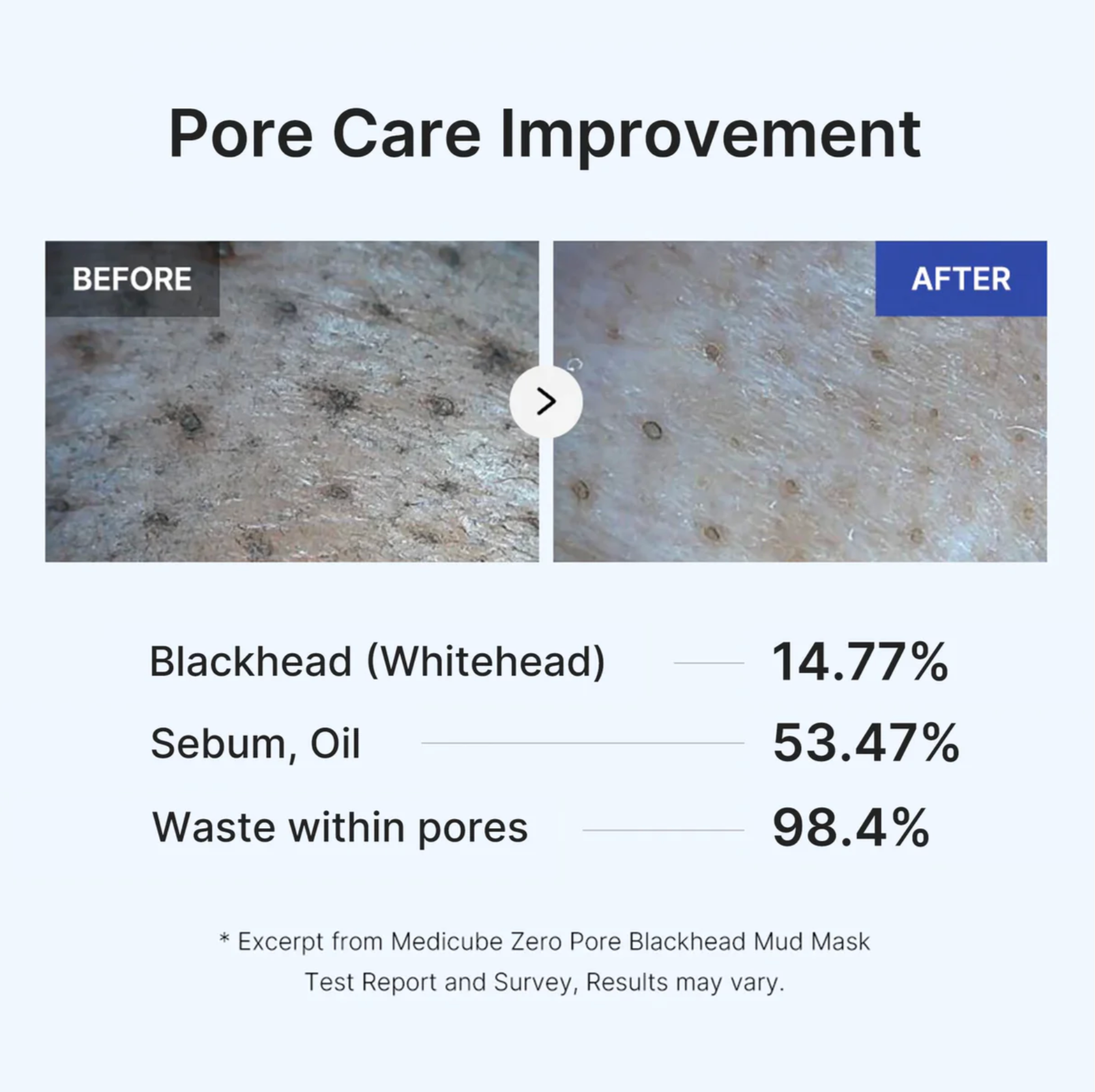 Zero Pore Blackhead Mud Mask